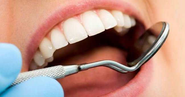 Konya Diş Dolgusu Fiyatları 2021 - Diş Dolgu Estetiği