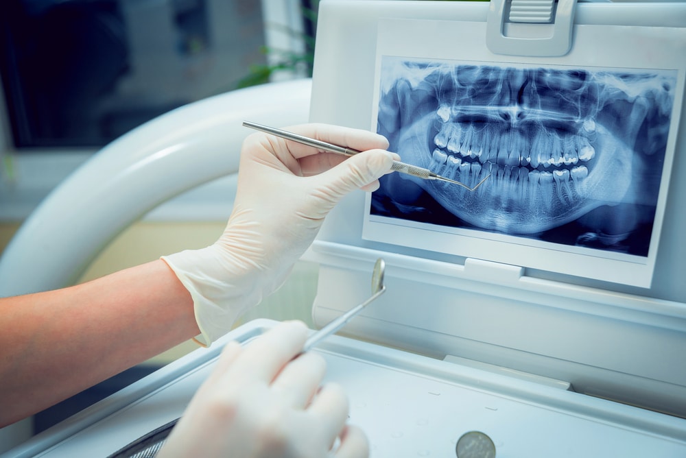 Konya Diş Muayenesi Ücretleri - Detaylı Muayene (Oral Diagnoz)