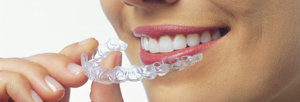 Şeffaf Diş Teli Tedavisi Nasıl Yapılır? Uzm. Dr. Ali İhsan Erkan